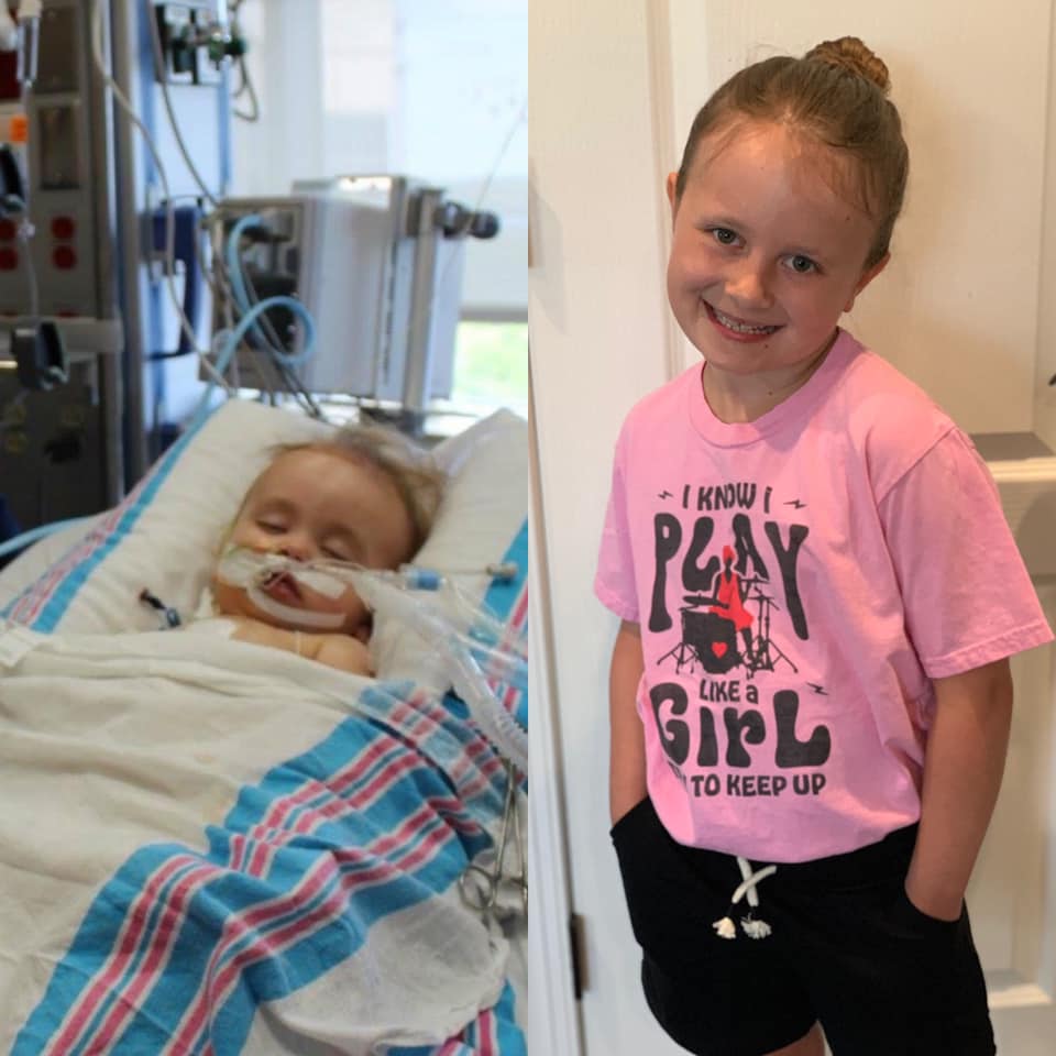 These two pictures were taken exactly eight years apart, to the day. What a #heartwarrior!